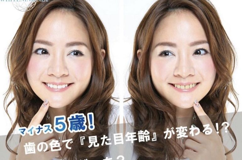 歯の色で見た目年齢が変わる！